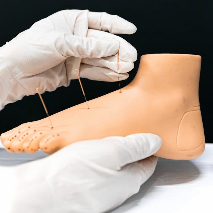 Hands Practice Acupuncture on Artificial Feet