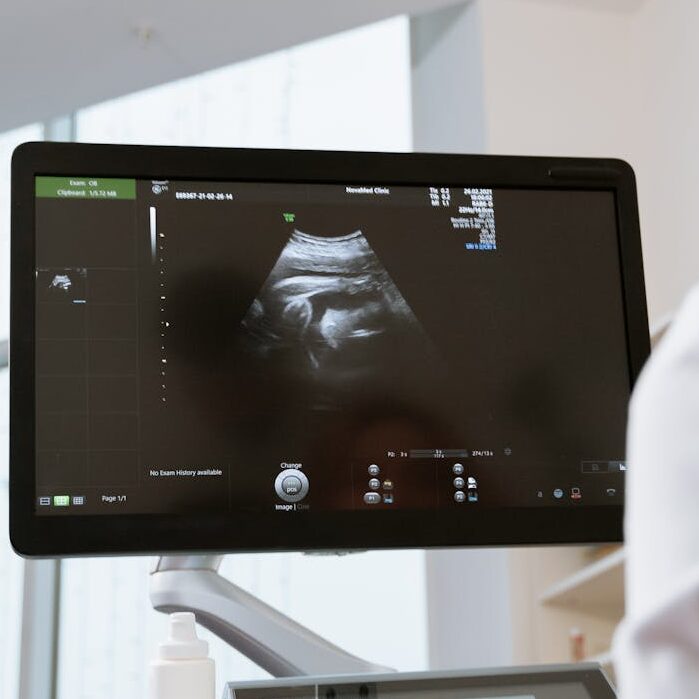 Photo Of An OB-GYN Looking In The Monitor